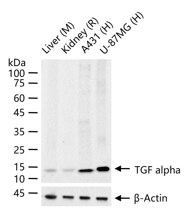 TGF alpha Rabbit pAb (一抗) - WB | Bioss