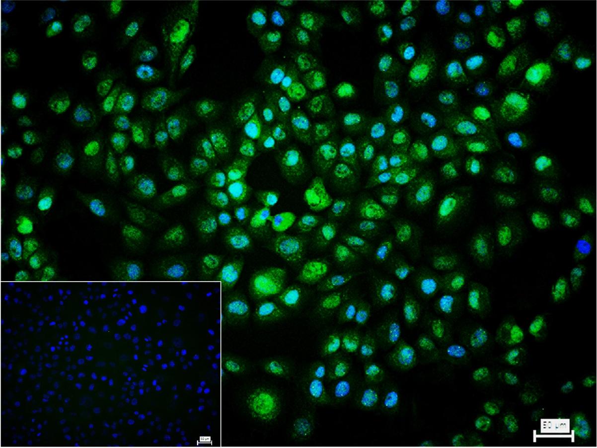 细胞信号转导分子SMAD3抗体-bs-3484R