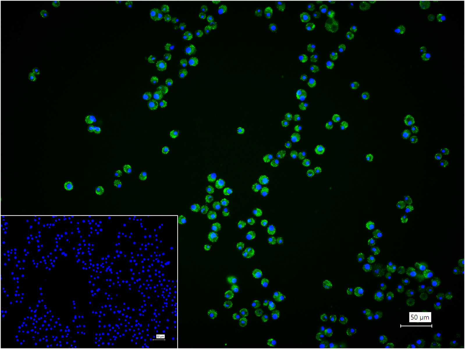 phospho-MLKL (Ser345) Rabbit pAb (一抗) - ICC/IF | Bioss