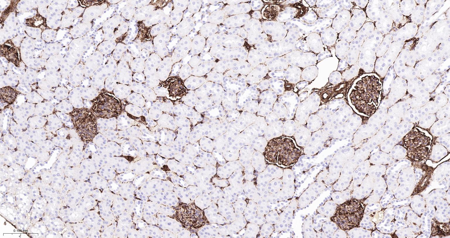 波形蛋白重组兔单抗-bsm-63101R