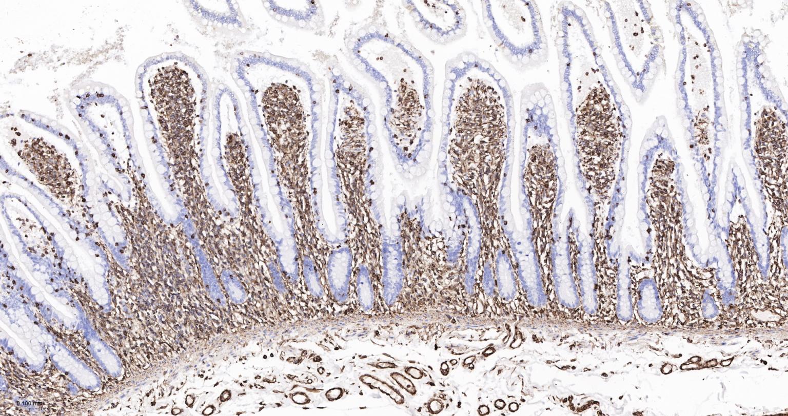 波形蛋白重组兔单抗-bsm-63101R