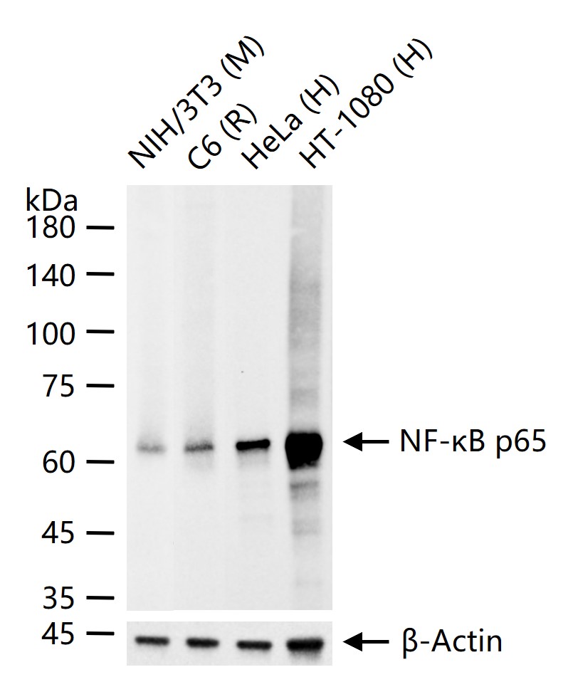 NF-κB p65 Recombinant Rabbit mAb (一抗) - WB,IHC-P,IHC-F,IF,Flow-Cyt | Bioss
