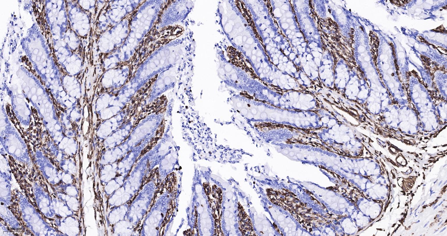 波形蛋白重组兔单抗-bsm-63101R