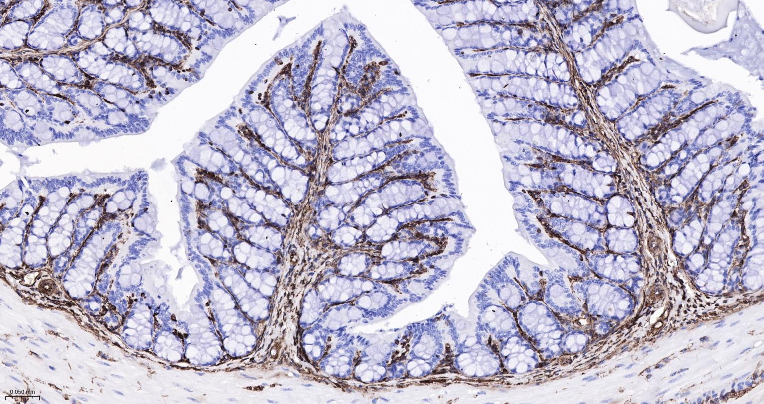 波形蛋白重组兔单抗-bsm-63101R