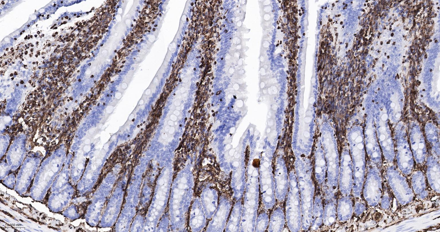 波形蛋白重组兔单抗-bsm-63101R
