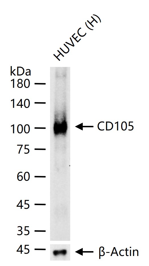 CD105 Recombinant Rabbit mAb (一抗) - WB | Bioss