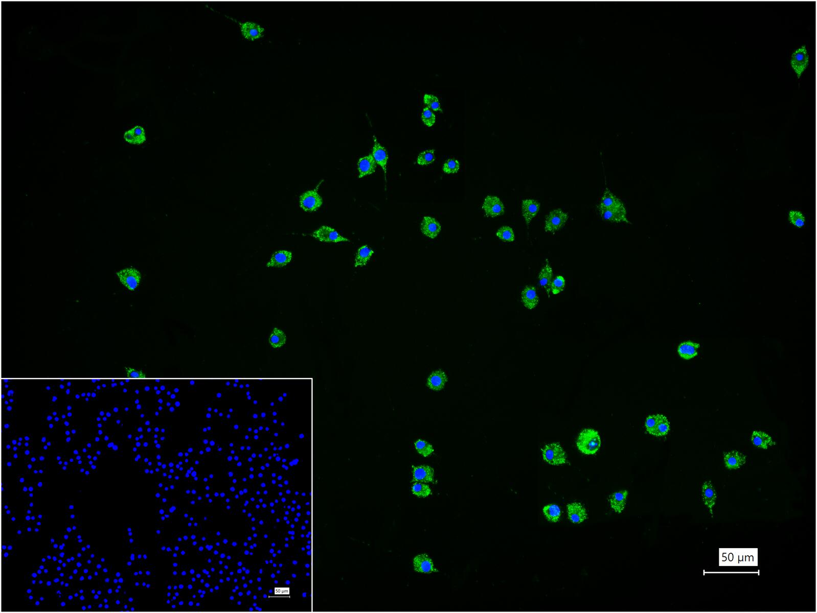 磷酸化MLKL抗体-bs-25447R