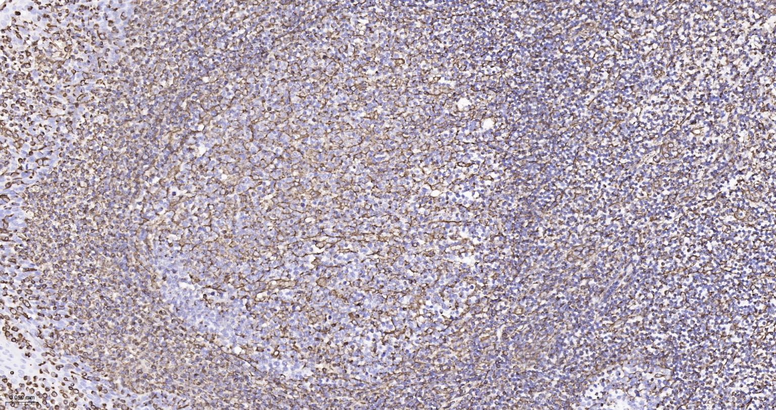 波形蛋白重组兔单抗-bsm-63101R