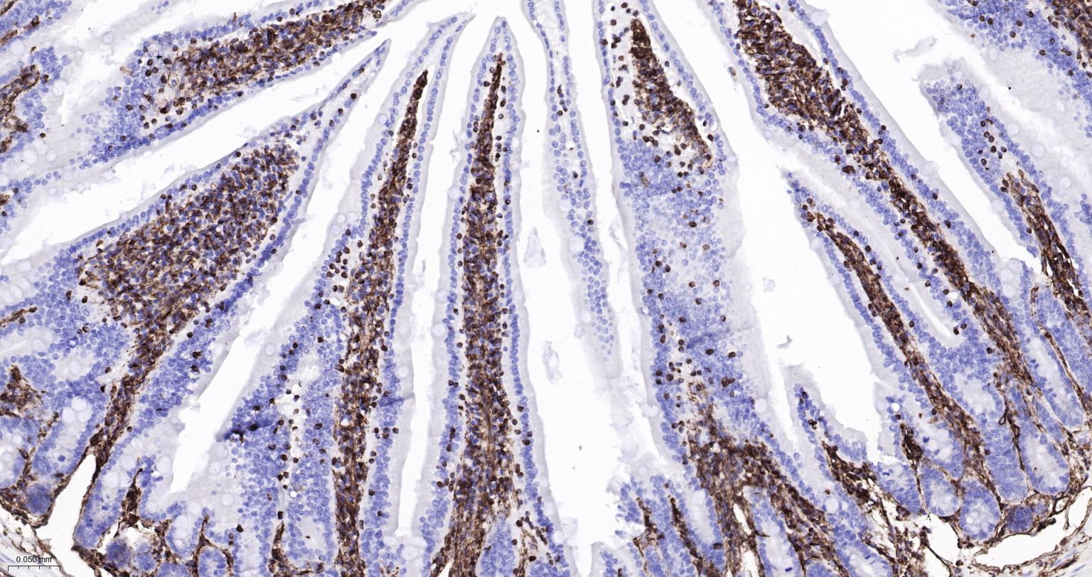 波形蛋白重组兔单抗-bsm-63101R