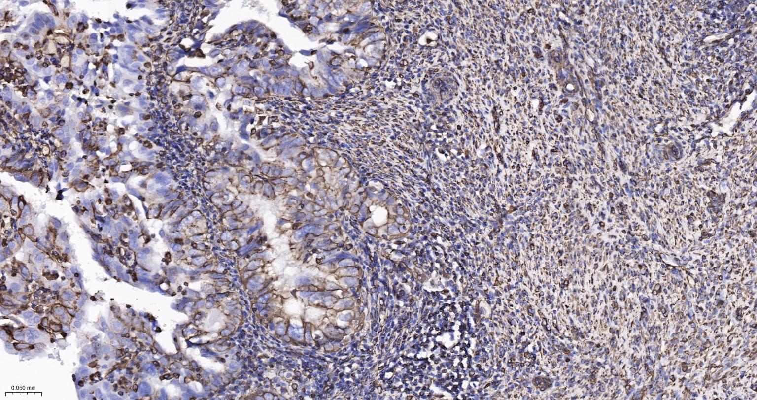 波形蛋白重组兔单抗-bsm-63101R