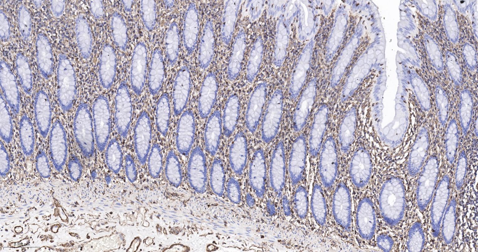 波形蛋白重组兔单抗-bsm-63101R