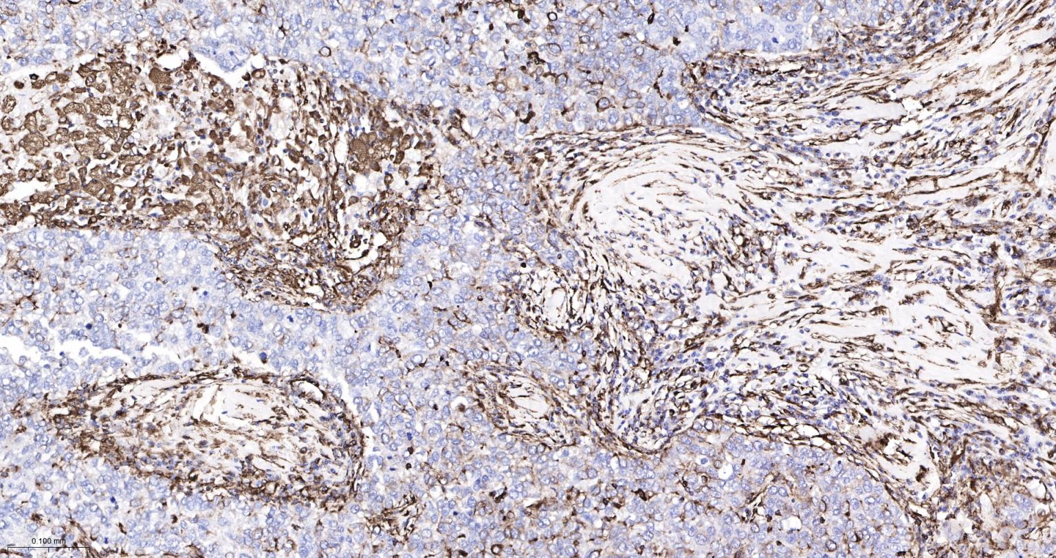 波形蛋白重组兔单抗-bsm-63101R