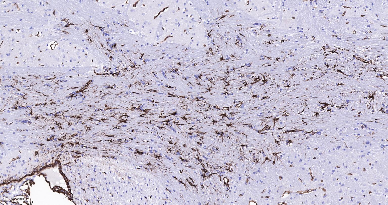 波形蛋白重组兔单抗-bsm-63101R
