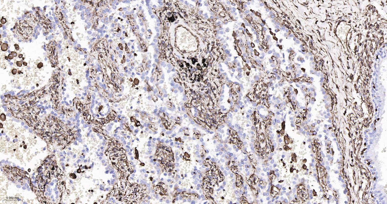 波形蛋白重组兔单抗-bsm-63101R