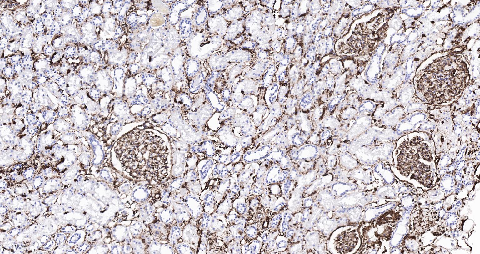 波形蛋白重组兔单抗-bsm-63101R