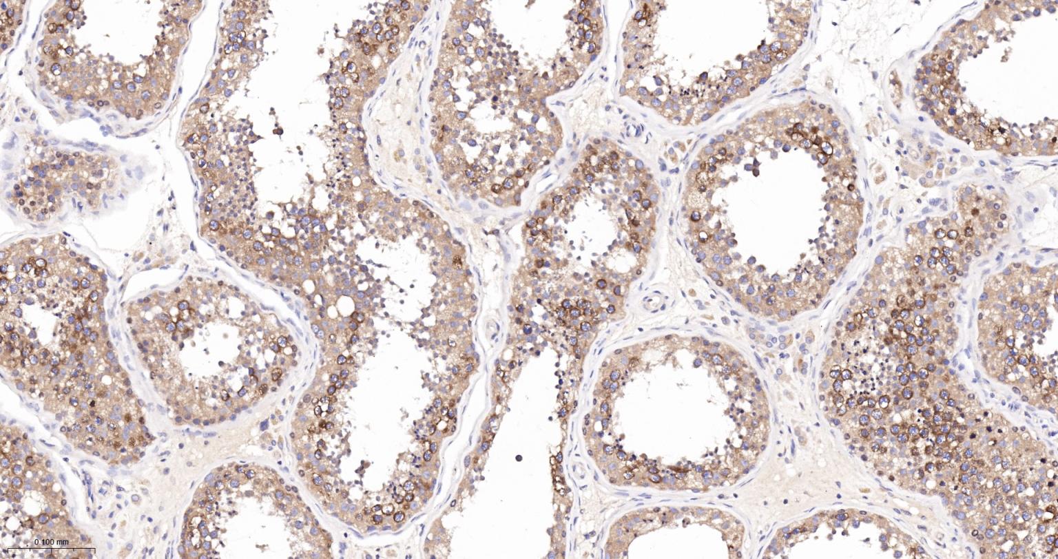 驱动蛋白2重组兔单抗-bsm-62372R