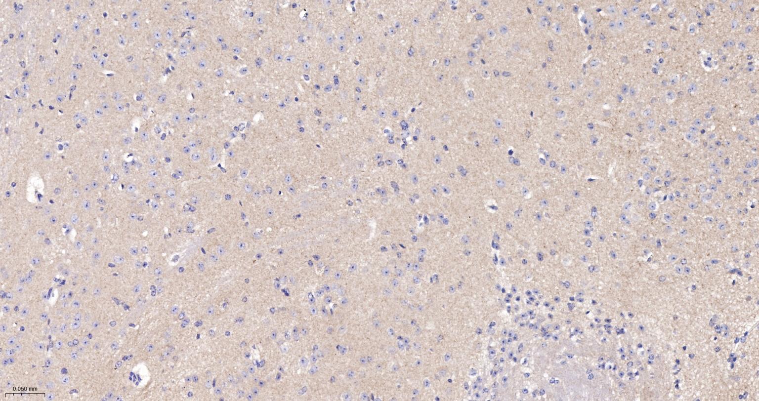 驱动蛋白2重组兔单抗-bsm-62372R