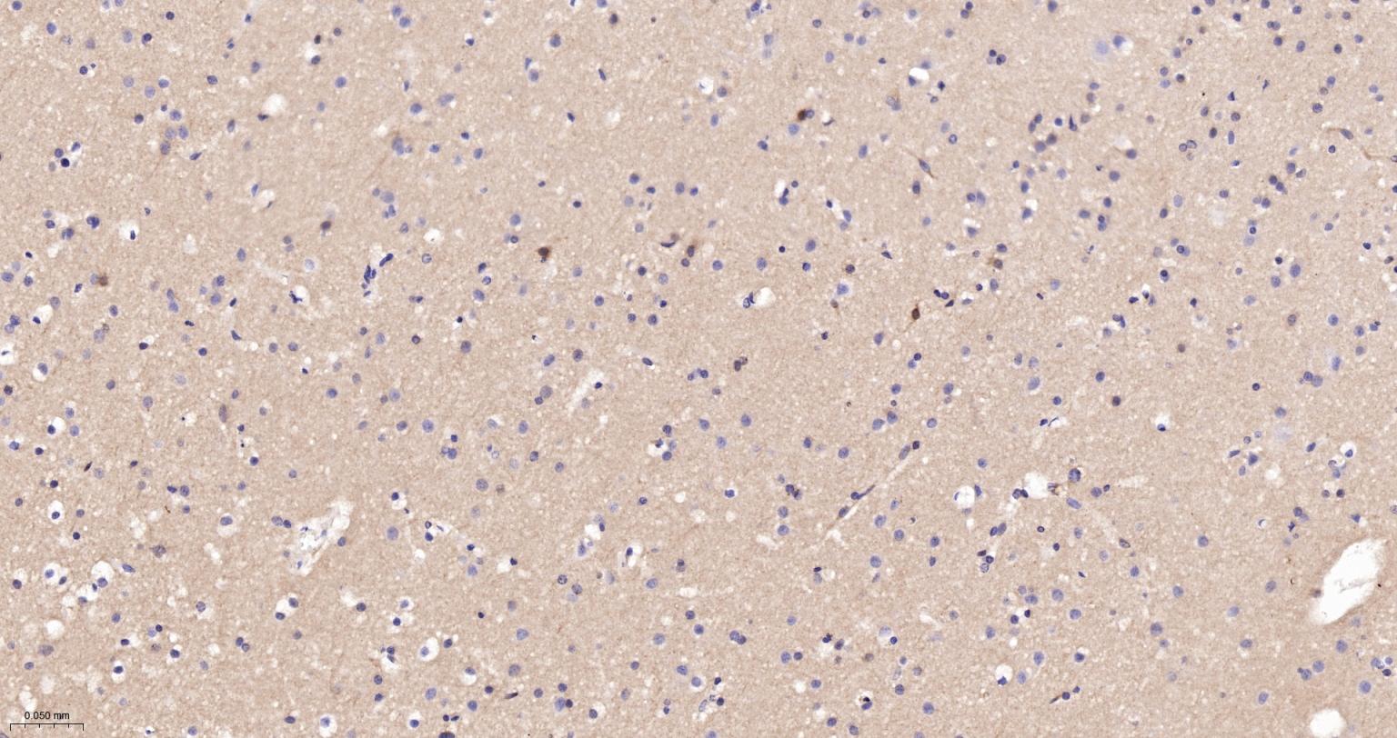 驱动蛋白2重组兔单抗-bsm-62372R