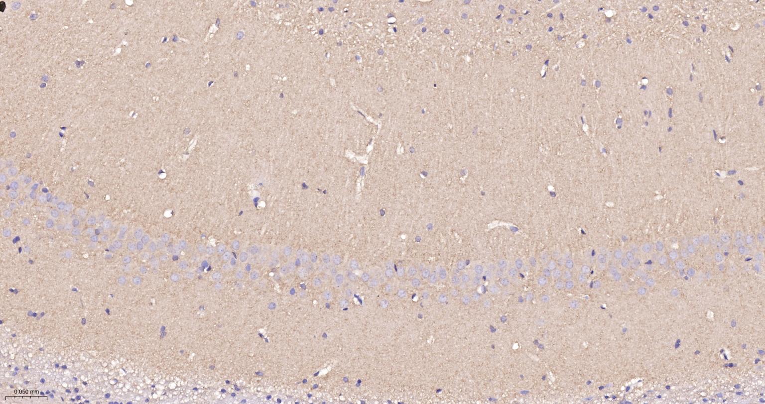 驱动蛋白2重组兔单抗-bsm-62372R