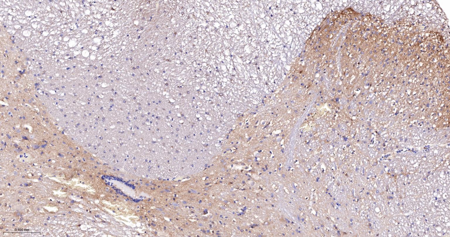 驱动蛋白2重组兔单抗-bsm-62372R