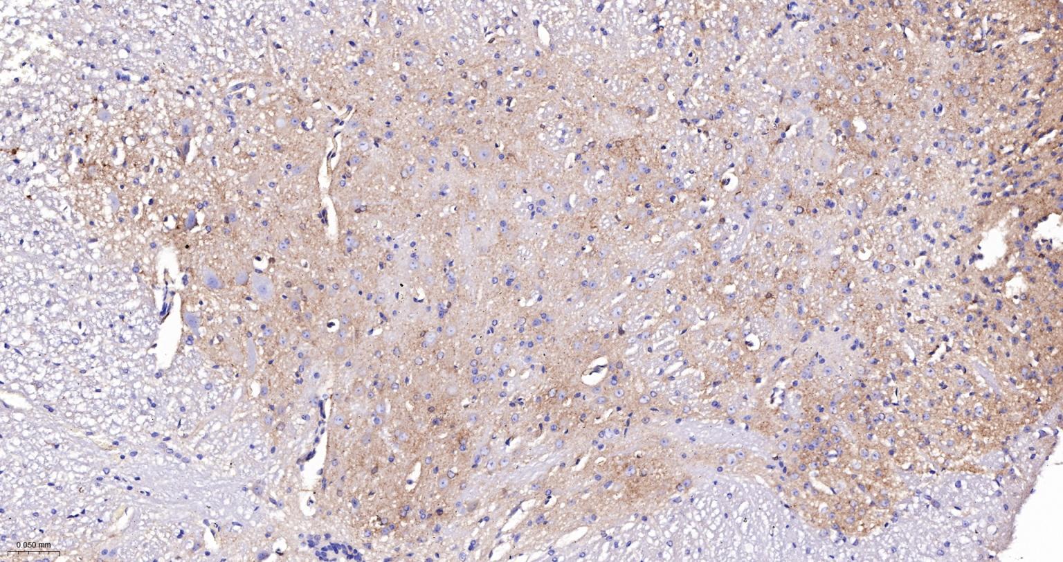 驱动蛋白2重组兔单抗-bsm-62372R
