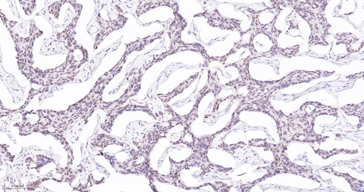 肿瘤错配修复基因PMS2重组兔单抗-bsm-63360R