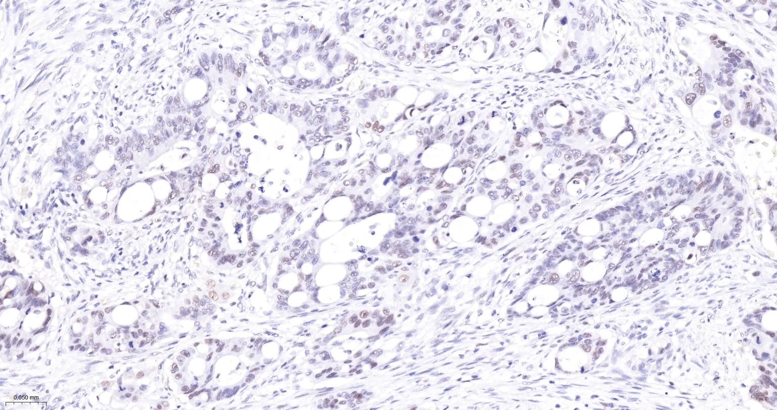 肿瘤错配修复基因PMS2重组兔单抗-bsm-63360R