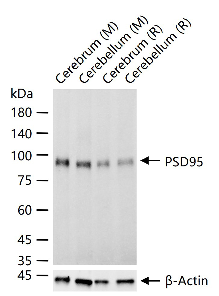 PSD95 Recombinant Rabbit mAb (一抗) - WB | Bioss