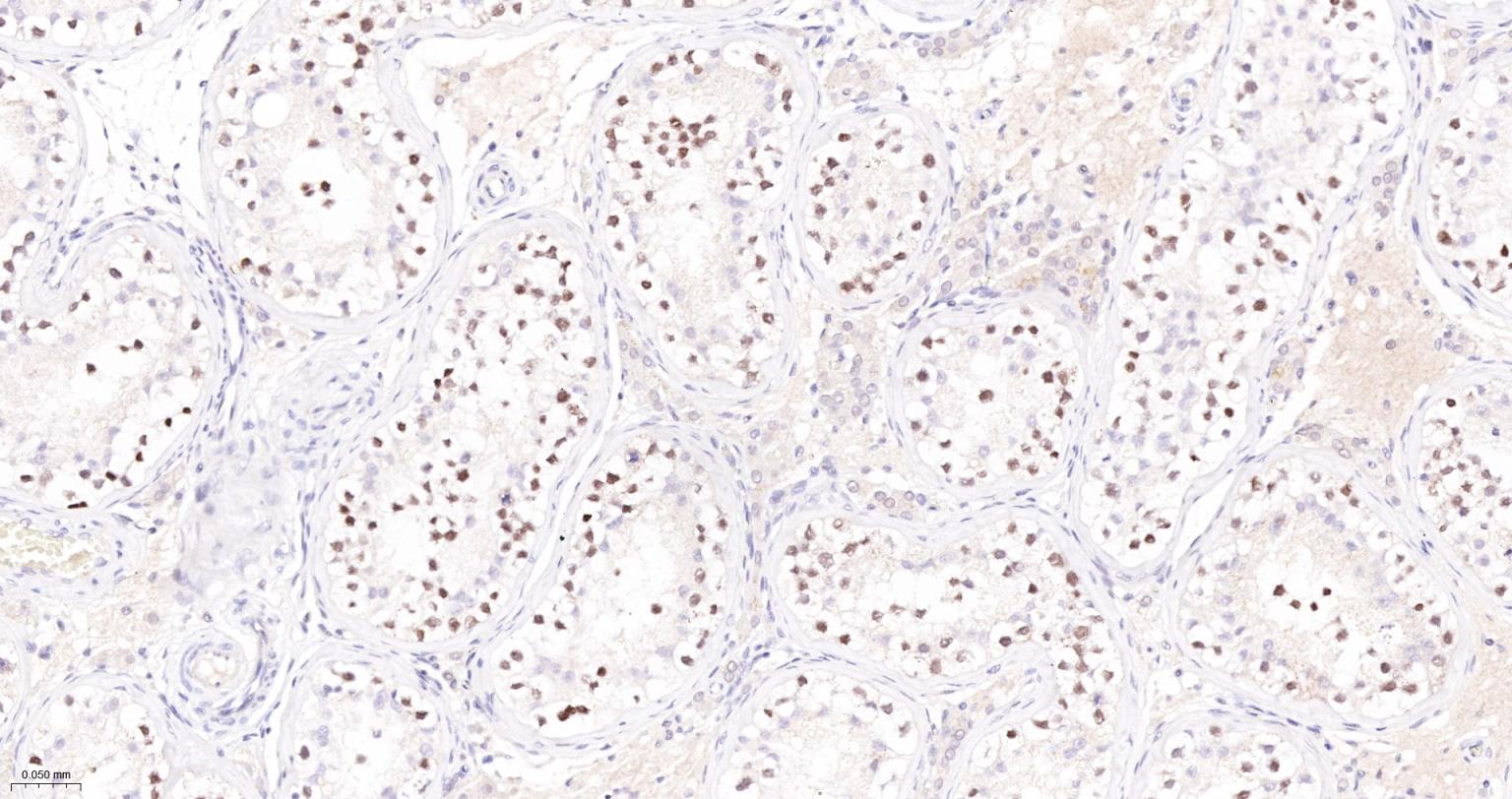 肿瘤错配修复基因PMS2重组兔单抗-bsm-63360R
