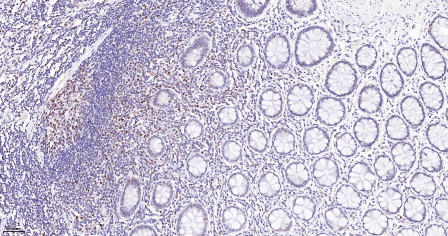 肿瘤错配修复基因PMS2重组兔单抗-bsm-63360R