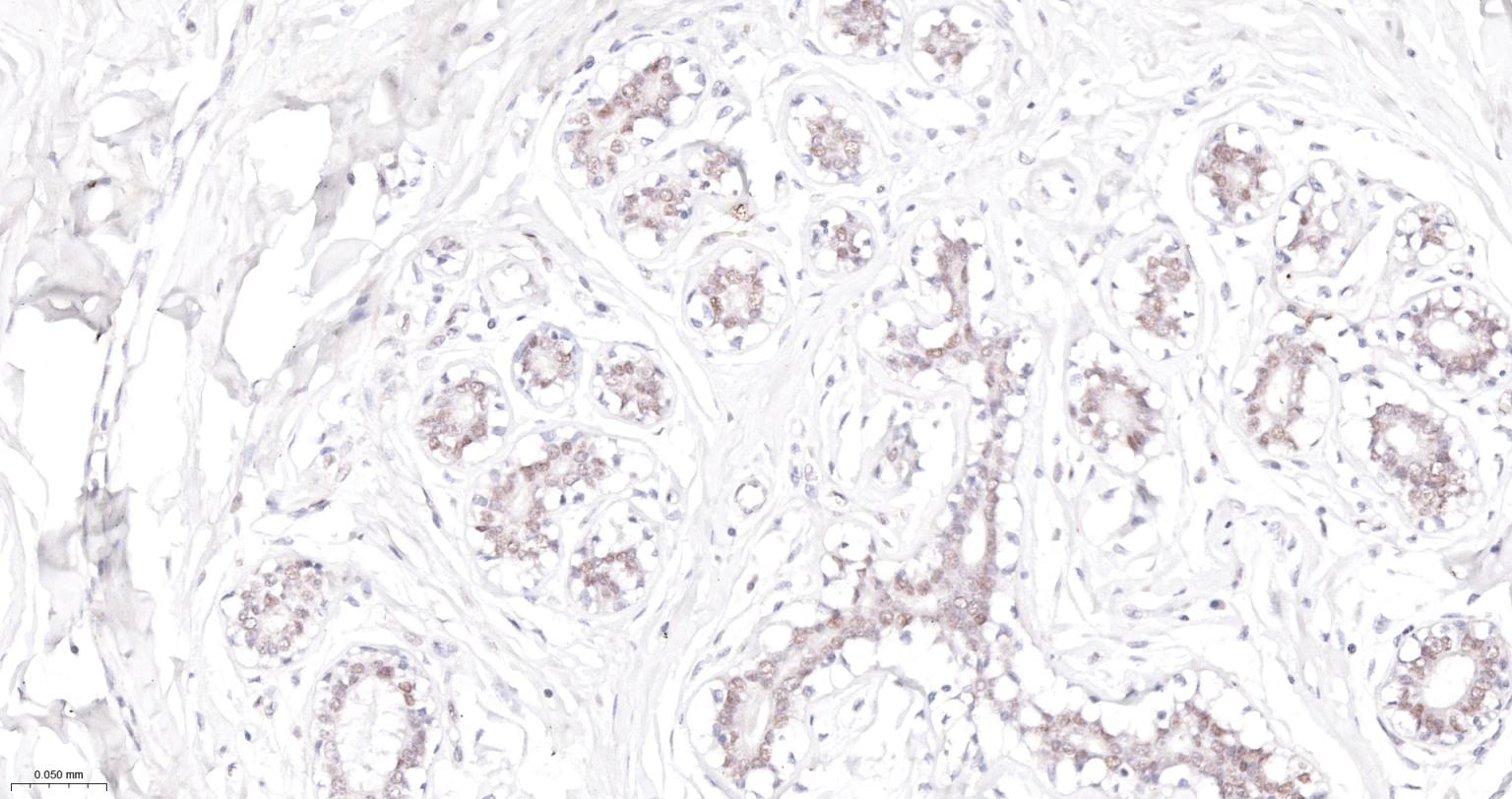肿瘤错配修复基因PMS2重组兔单抗-bsm-63360R