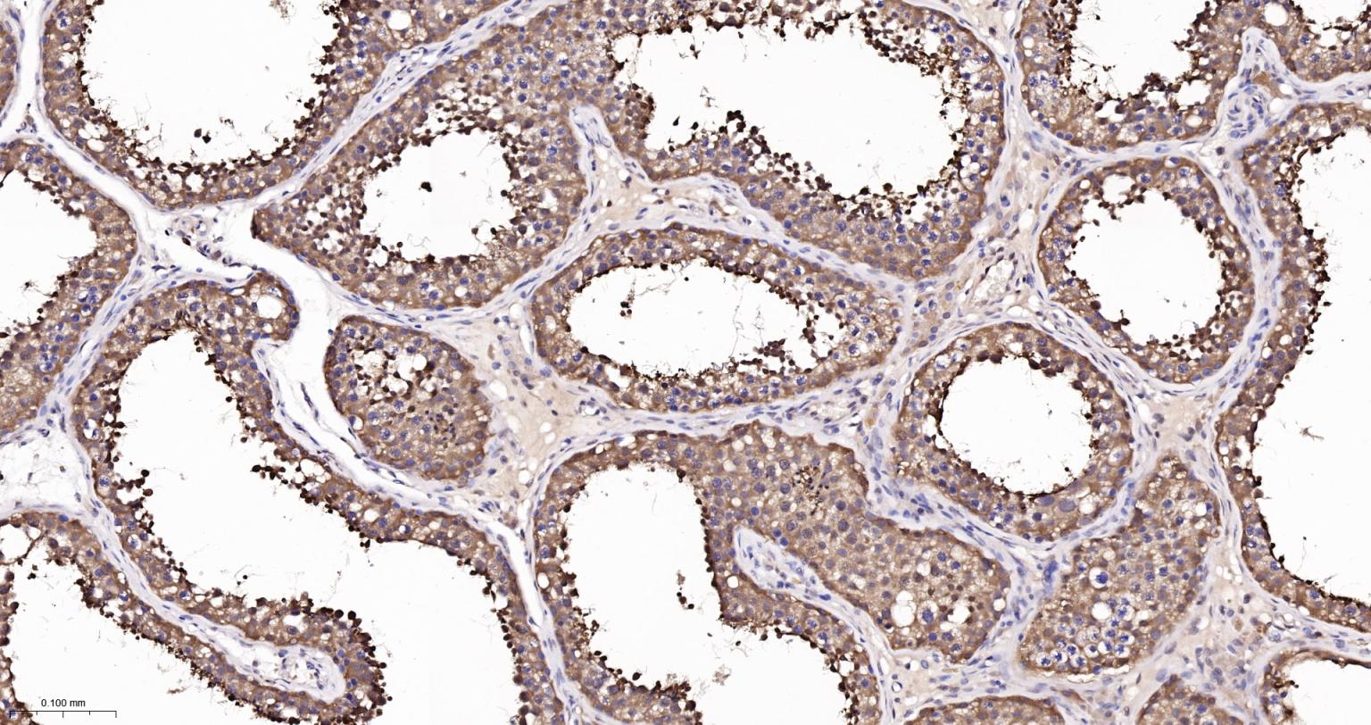 组氨酸三聚体核苷结合蛋白1重组兔单抗-bsm-62612R