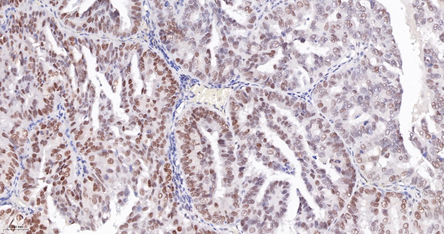 肿瘤错配修复基因PMS2重组兔单抗-bsm-63360R