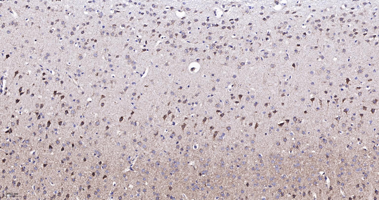 ATP5A重组兔单抗-bsm-61444R