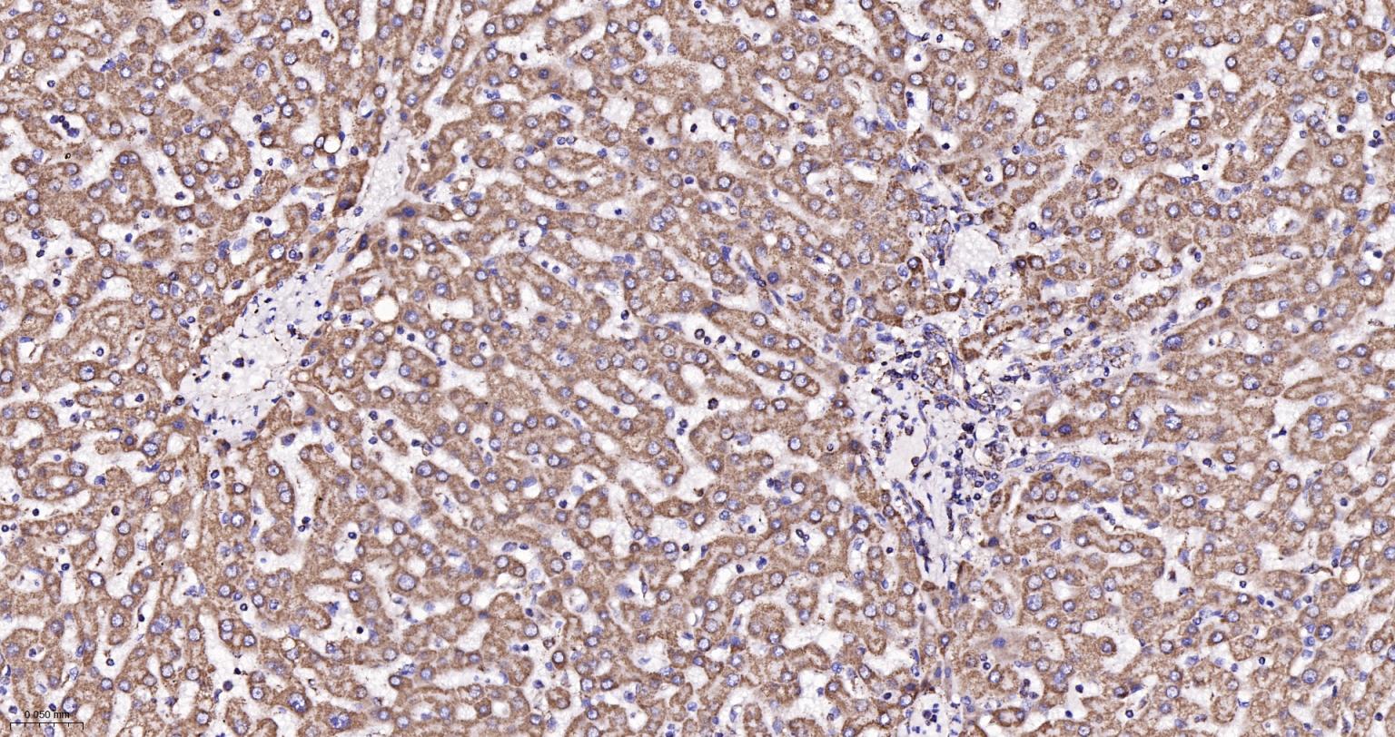 ATP5A重组兔单抗-bsm-61444R