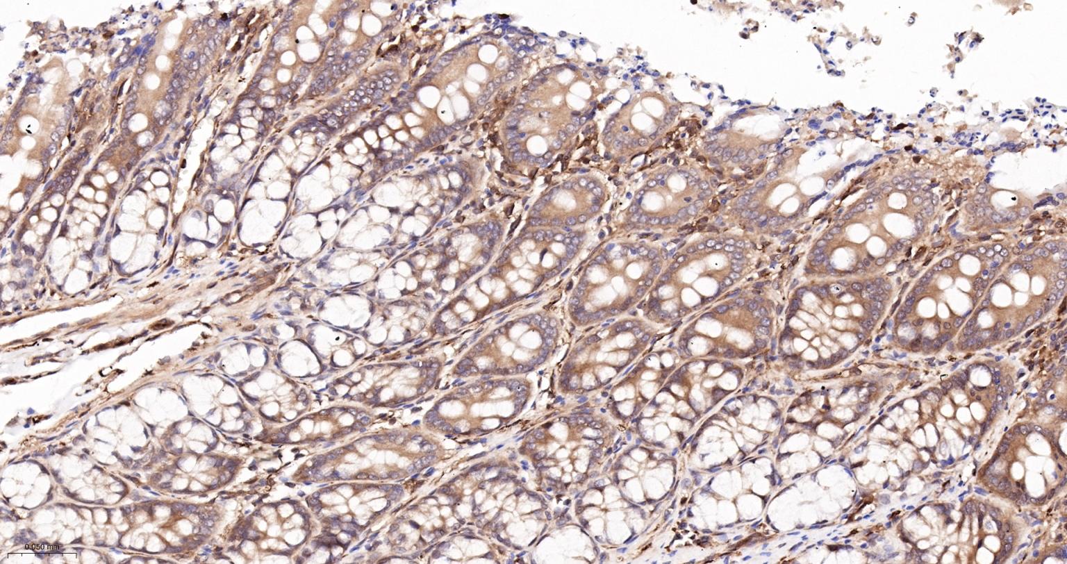 细胞核因子/k基因结合核因子重组兔单抗-bsm-55650R