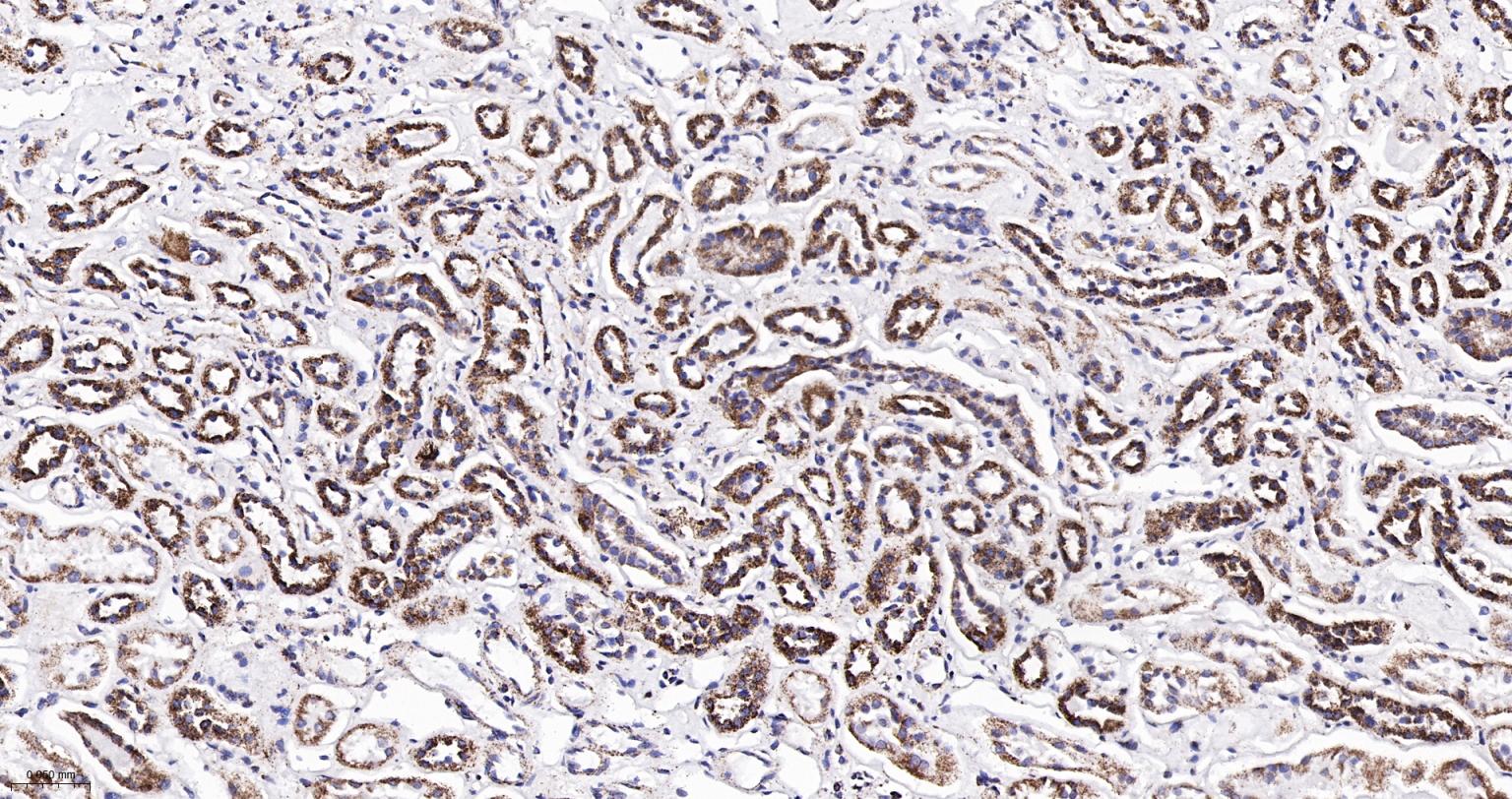 ATP5A重组兔单抗-bsm-61444R