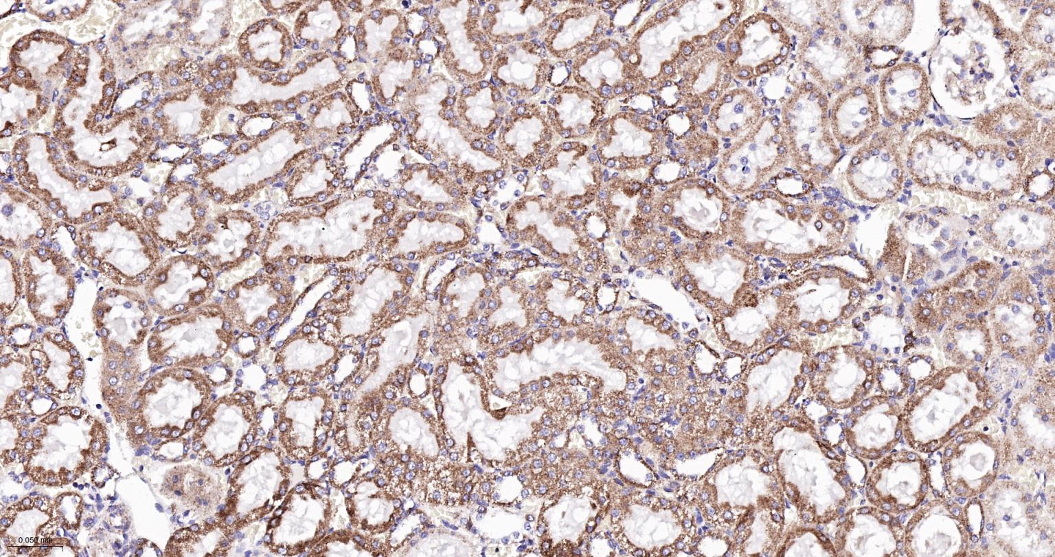 ATP5A重组兔单抗-bsm-61444R