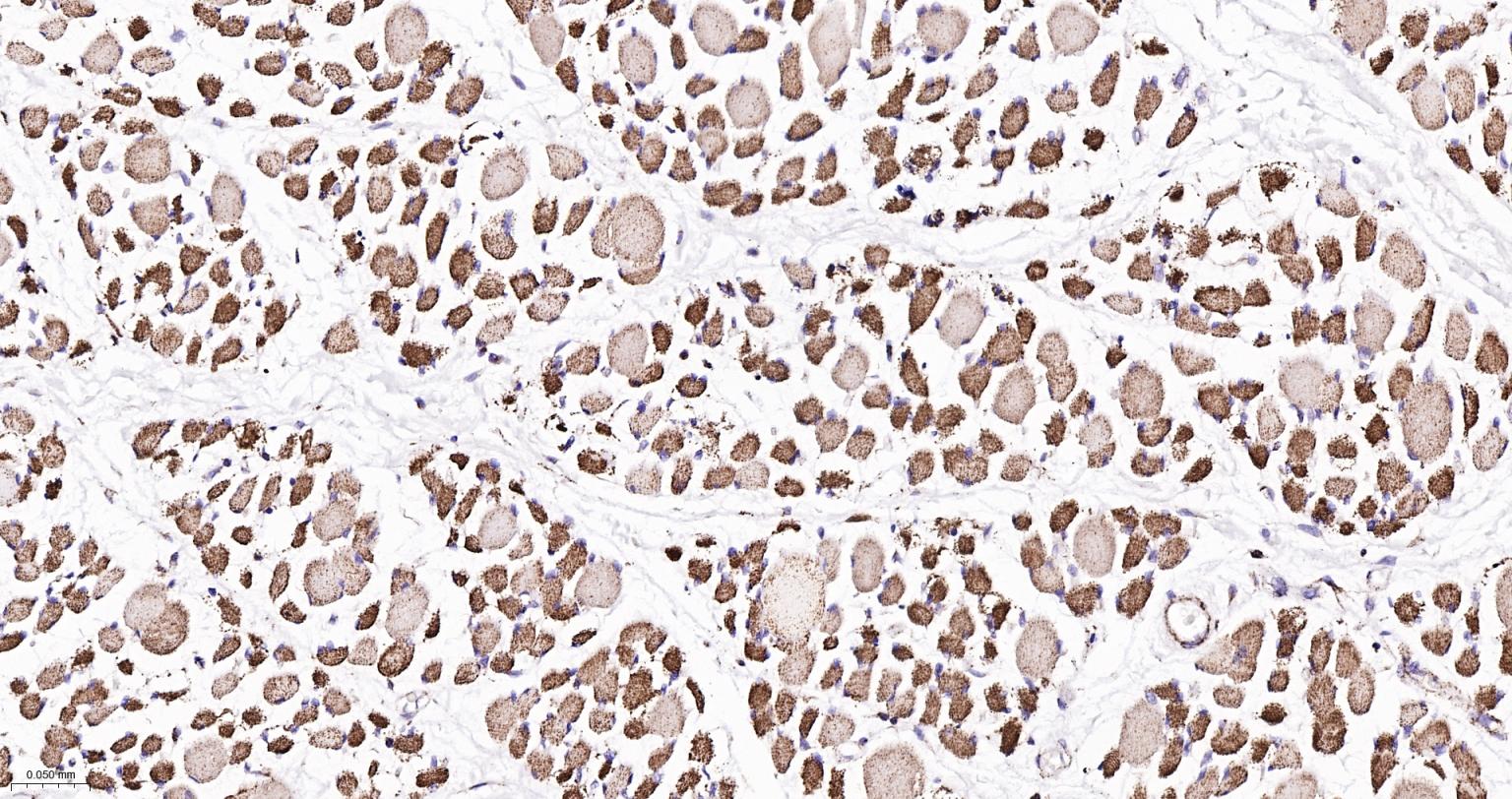 ATP5A重组兔单抗-bsm-61444R