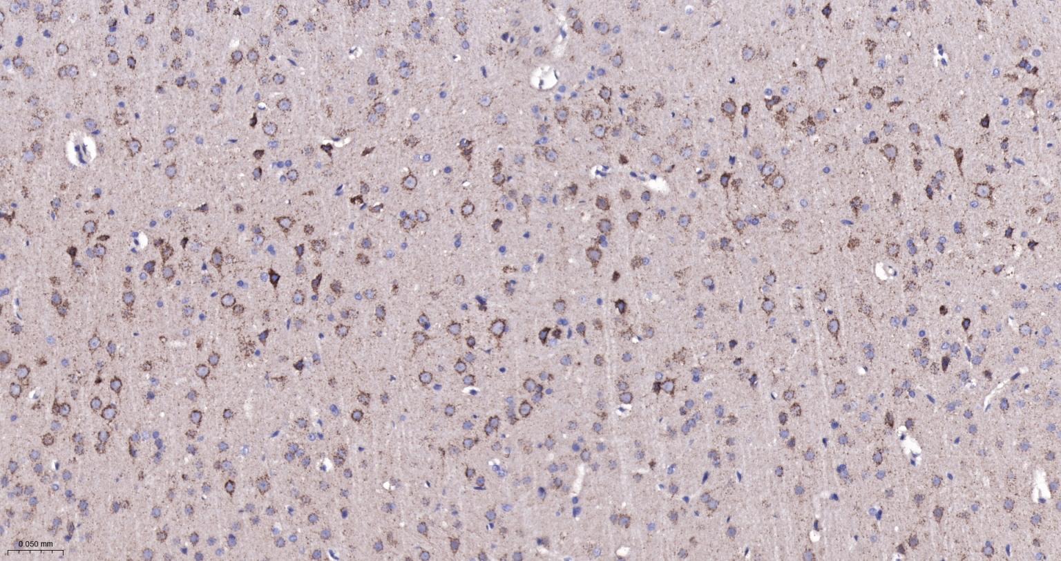 ATP5A重组兔单抗-bsm-61444R