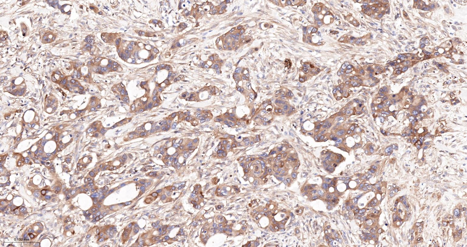 细胞核因子/k基因结合核因子重组兔单抗-bsm-55650R