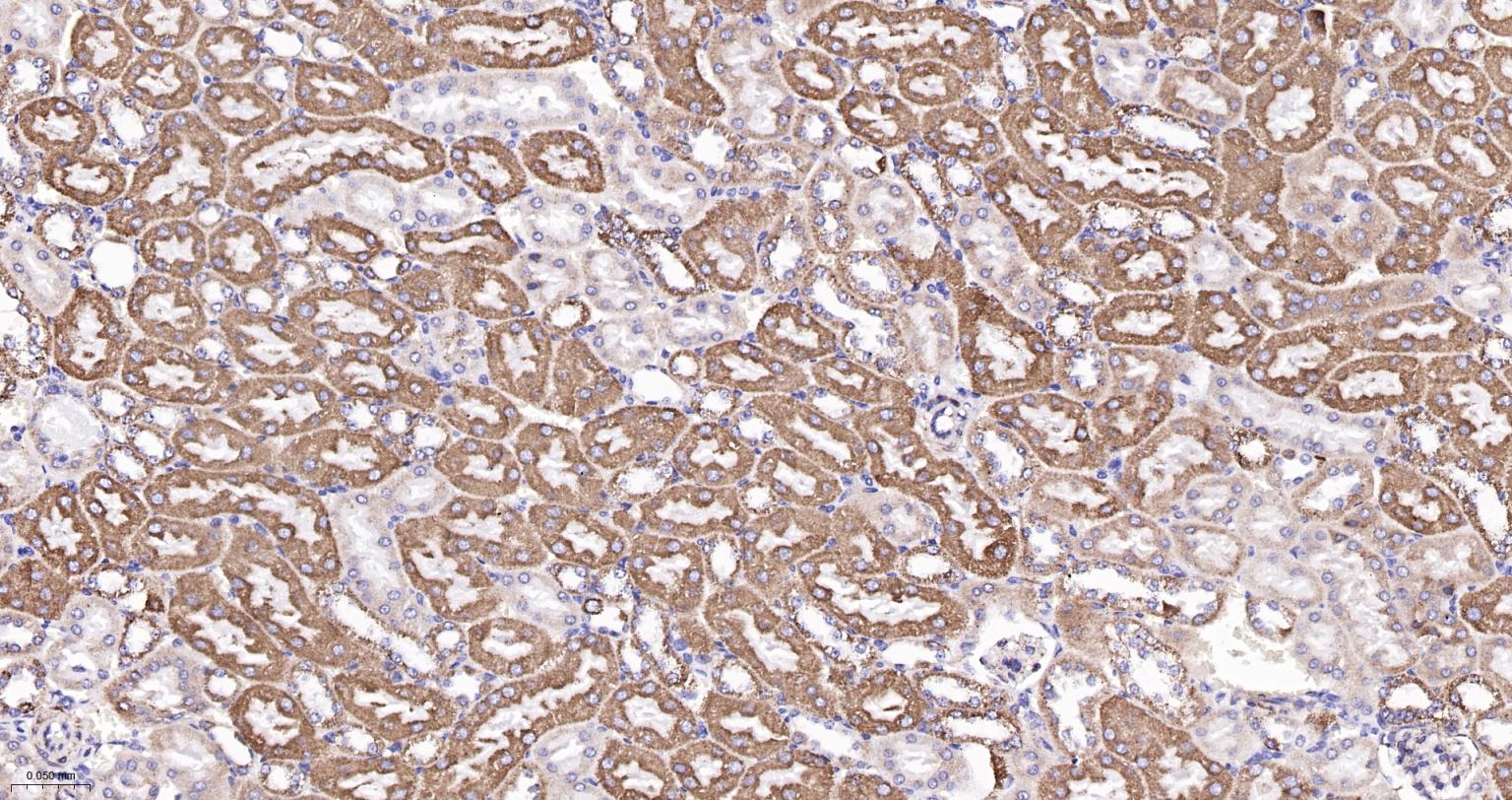 ATP5A重组兔单抗-bsm-61444R