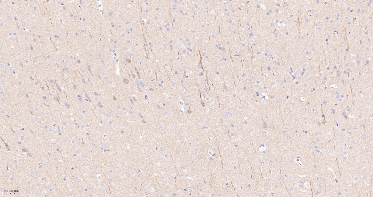 突触后密度蛋白95重组兔单抗-bsm-55665R