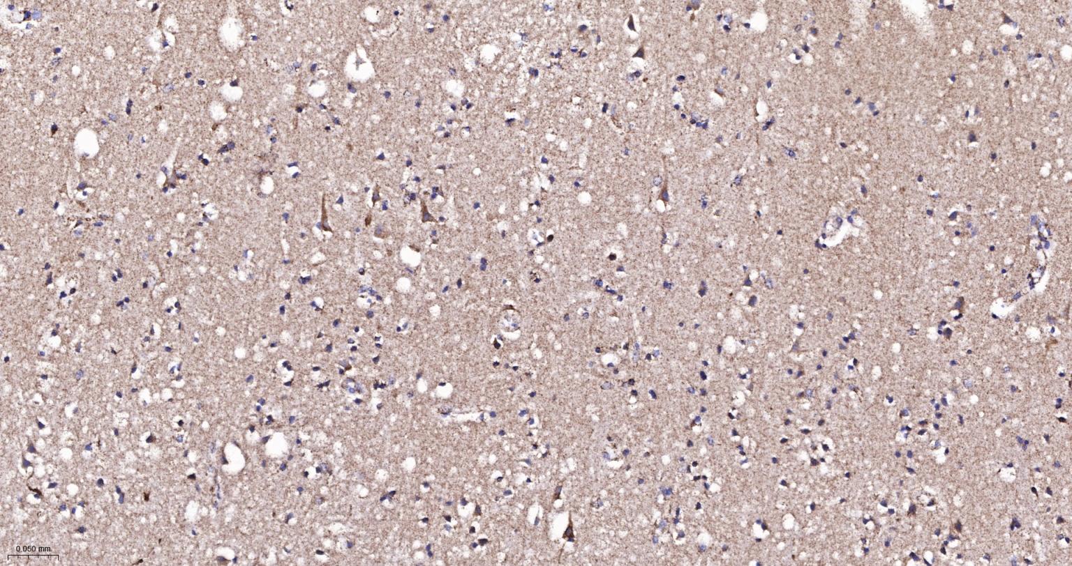 ATP5A重组兔单抗-bsm-61444R