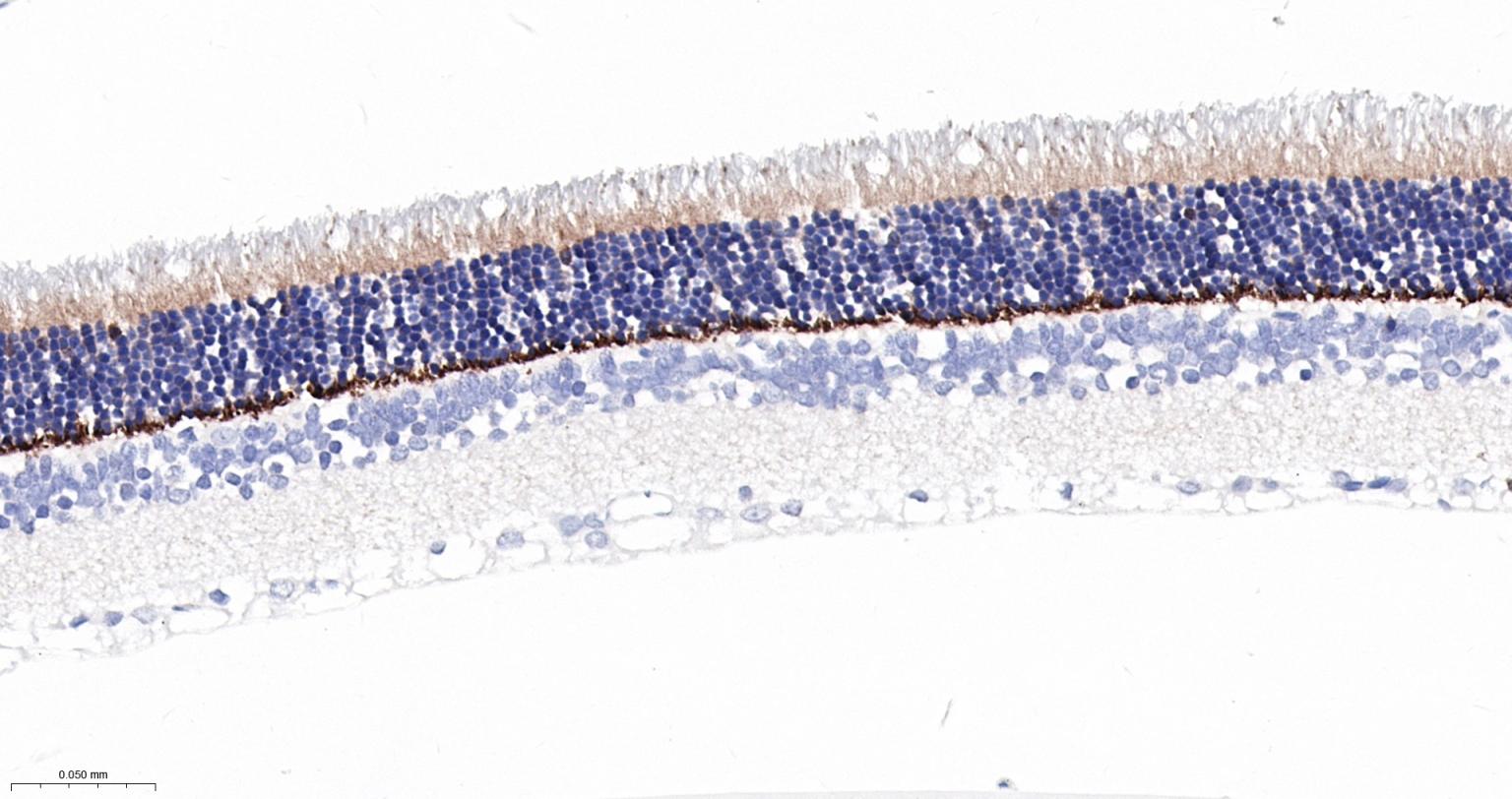 突触后密度蛋白95重组兔单抗-bsm-55665R