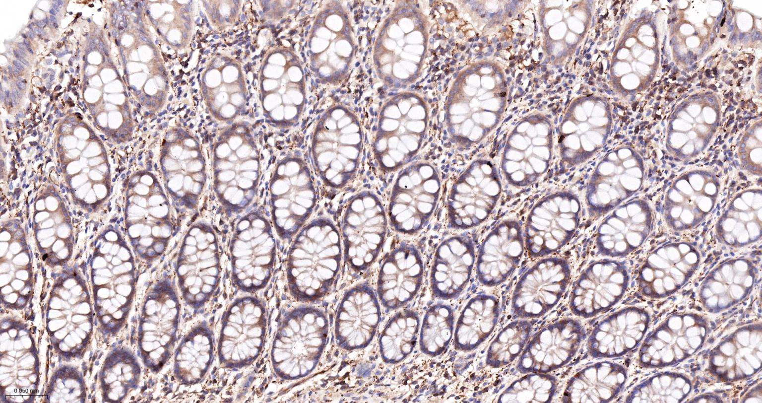 细胞核因子/k基因结合核因子重组兔单抗-bsm-55650R