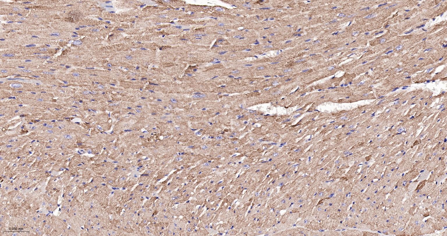 ATP5A重组兔单抗-bsm-61444R