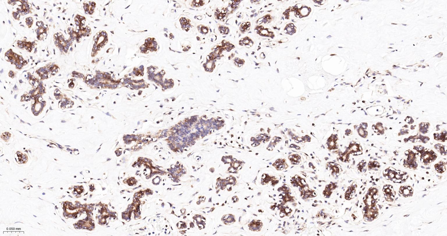 细胞核因子/k基因结合核因子重组兔单抗-bsm-55650R