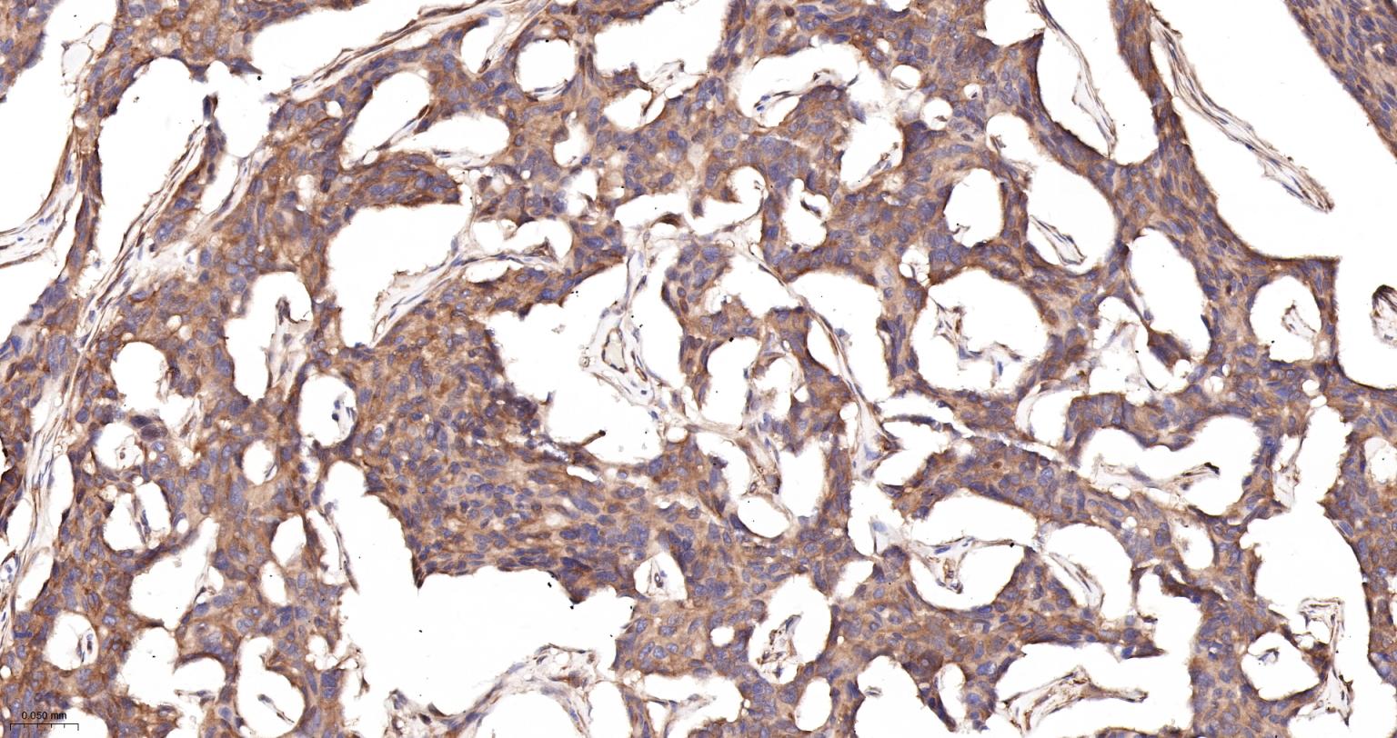 细胞核因子/k基因结合核因子重组兔单抗-bsm-55650R