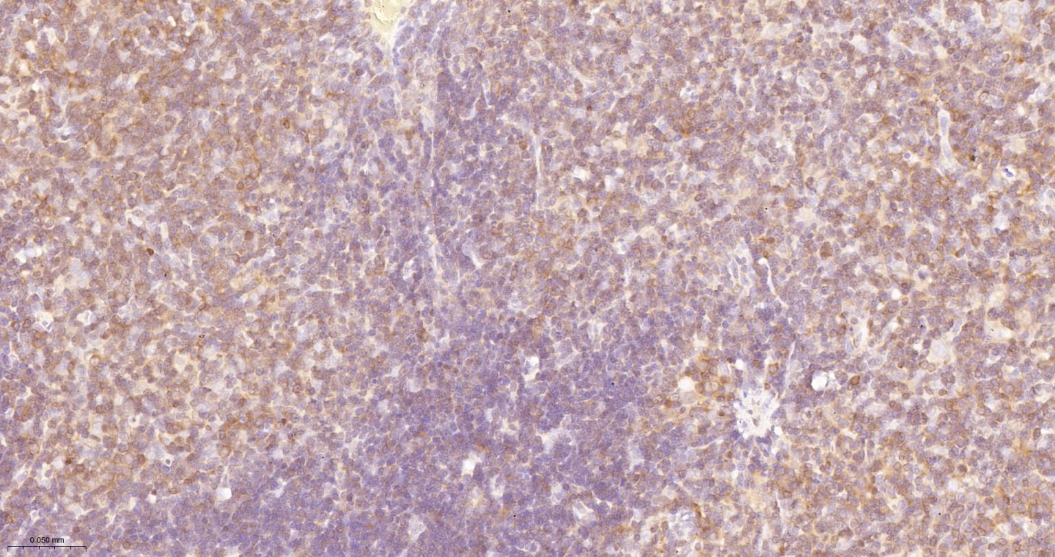 细胞核因子/k基因结合核因子重组兔单抗-bsm-55650R